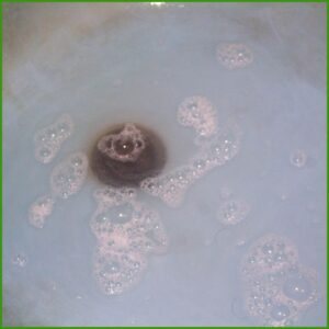 Severity of the Clog